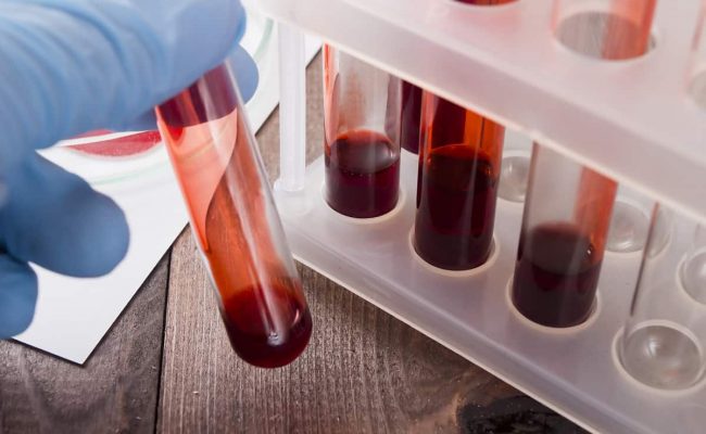 تحليل cbc الدم الشامل