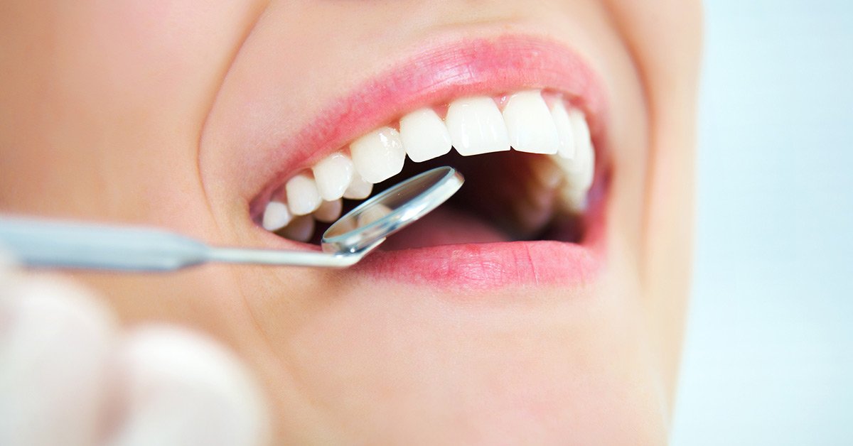 Výklad sna o zmene tvaru zubov pre slobodné ženy